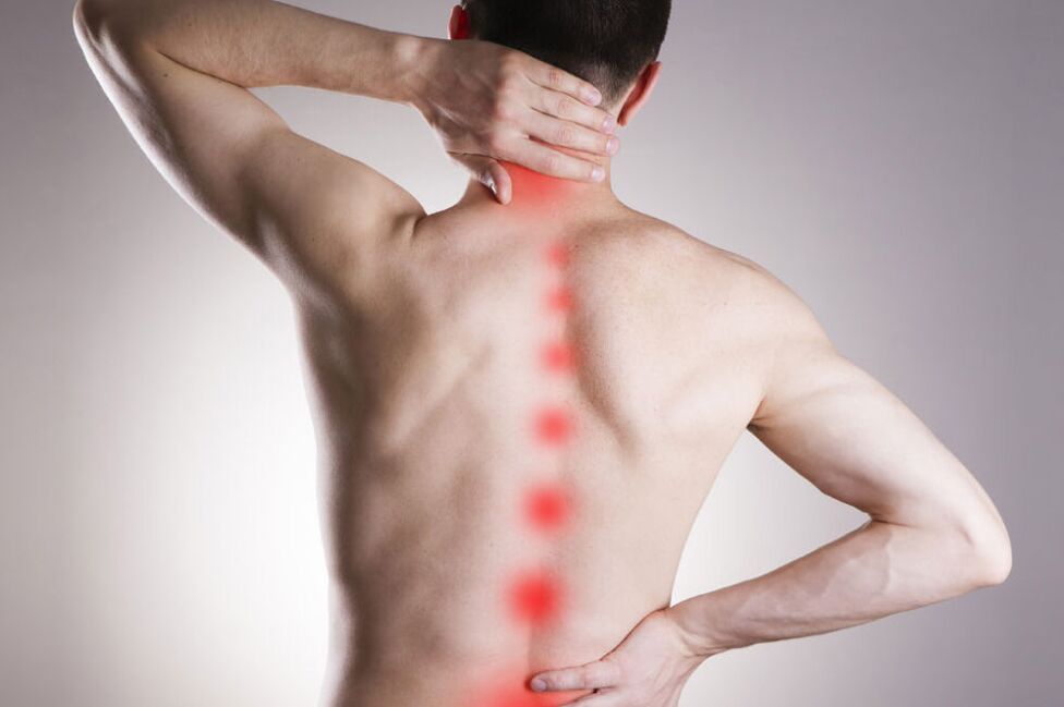 Kas yra osteochondrozė